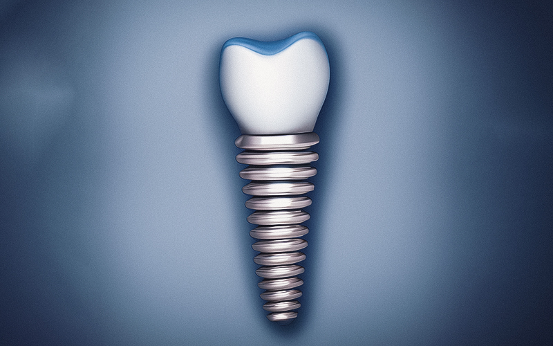 Embora o estudo tenha incluído um pequeno número de pacientes, os resultados mostram que os implantes permanecem no lugar e que a perda óssea ao redor deles permanece praticamente inalterada após 40 anos