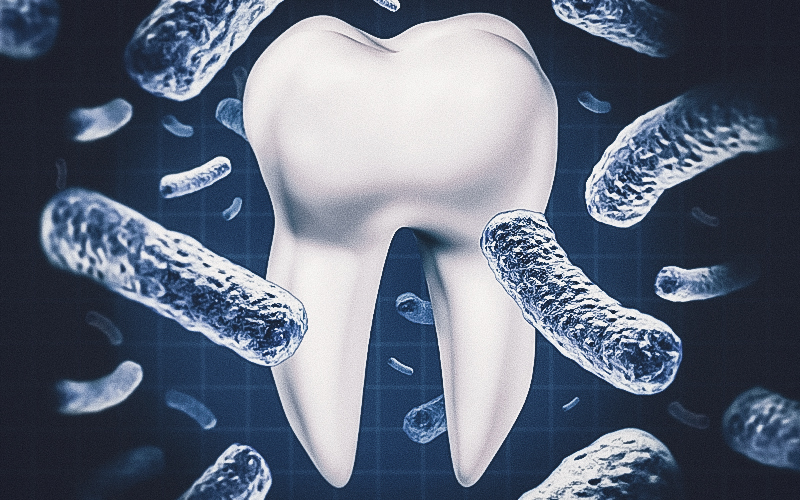 Infecções odontogênicas têm potencial de rápida evolução e sérias complicações