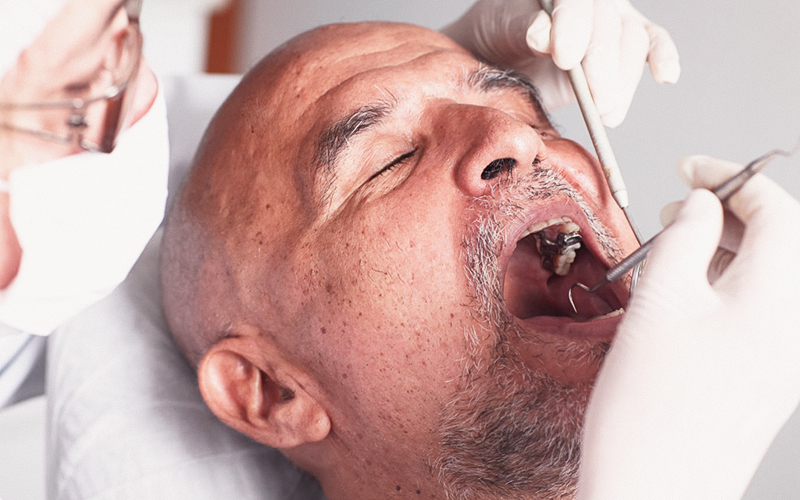 O câncer bucal pode se desenvolver em áreas como língua, gengiva, céu da boca e garganta