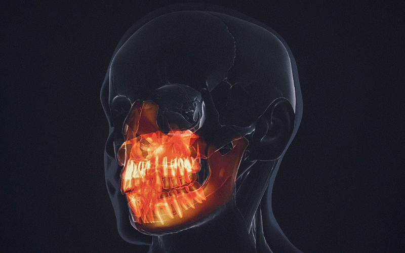 Uso combinado de scanners e softwares avançados de escultura digital possibilita uma redução significativa de custos e garante alta precisão na confecção de modelos para próteses impressas em 3D