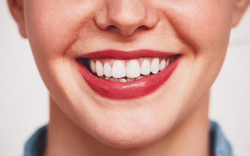 Doença periodontal não pode ser dissociada do risco para a saúde sistêmica