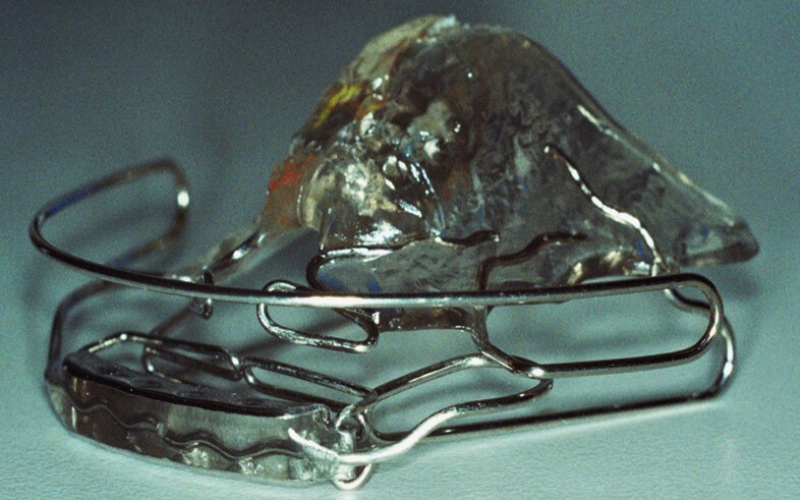 Entre os objetivos do tratamento estão alcançar um plano oclusal paralelo ao Plano de Camper, reabilitar dinamicamente a mastigação e favorecer a respiração buco-nasal